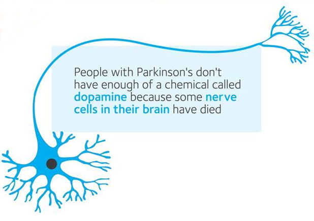 Parkinsons Slide 2